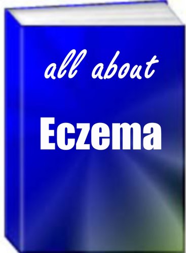 All About Eczema