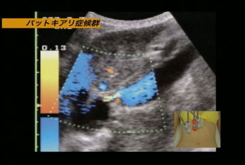 “の”の字2回走査法で出来る! 超音波手技大原則〈第3巻〉 ケアネットDVD