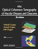 Atlas Optical Coherence Tomography of Macular Diseases and Glaucoma, 3rd Edition with DVD ROM