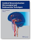 Cerebral Revascularization: Microsurgical and Endovascular Techniques