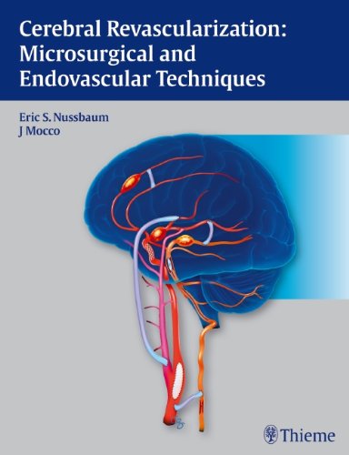 Cerebral Revascularization: Microsurgical and Endovascular