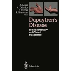 Dupuytren's Disease. Pathobiochemistry and Clinical Management