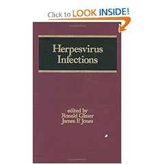 Herpesvirus Infections (Infectious Disease and Therapy) by Ronald Glaser