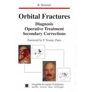 Click here to buy Orbital Fractures: Diagnosis, Operative Treatment, Secondary Corrections by B. Hammer.