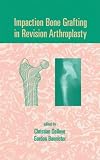 Review Informa HealthCare  / Impaction Bone Grafting in Revision Arthroplasty