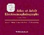 Atlas of Adult Electroencephalography