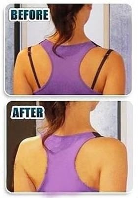 Bra Strap Solution Assorted Colors 9pcs/box