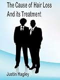 The Cause of Hair Loss and its Treatment