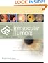 Intraocular Tumors: An Atlas and Text