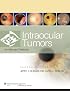 Intraocular Tumors: An Atlas and Text