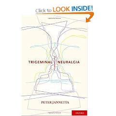 Trigeminal Neuralgia
