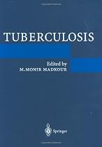 Tuberculosis