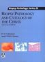 Biopsy Pathology and Cytology of the Cervix (Access to History)