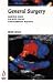 Lecture Notes on General Surgery