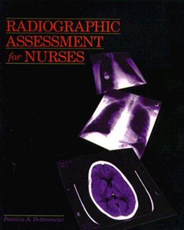 Radiographic Assessment For Nurses, 1e