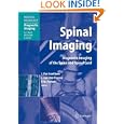 Spinal Imaging: Diagnostic Imaging of the Spine and Spinal Cord (Medical Radiology Diagnostic... by Johan W.M. van Goethem, Luc van den Hauwe, Paul M. Parizel, and A.L. Baert