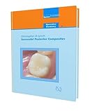 Successful posterior composites