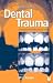 Handbook of Dental Trauma: A Practical Guide to the Treatment of Trauma to the Teeth