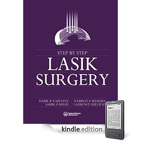 Step by Step LASIK Surgery