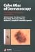 Books : Color Atlas of Dermatoscopy
