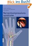 Nervenkompressionssyndrome