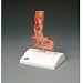 Esophagus Anatomical Model with Reflux & Ulcer Disease