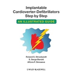 Implantable Cardioverter - Defibrillators Step by Step: An Illustrated Guide