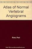 An atlas of normal vertebral angiograms