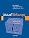 Atlas of Trichoscopy: Dermoscopy in Hair and Scalp Disease