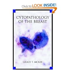 Cytopathology of the Breast with Imaging and Histologic Correlation