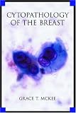 Cytopathology of the Breast with Imaging and Histologic Correlation