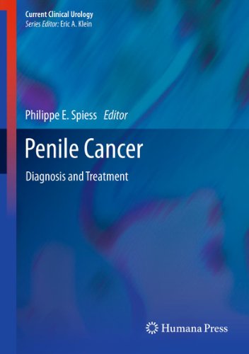 Penile Cancer: Diagnosis and Treatment (Current Clinical Urology)