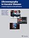 Books : Ultrasonography in Vascular Diseases: A Practical Approach to Clinical Problems