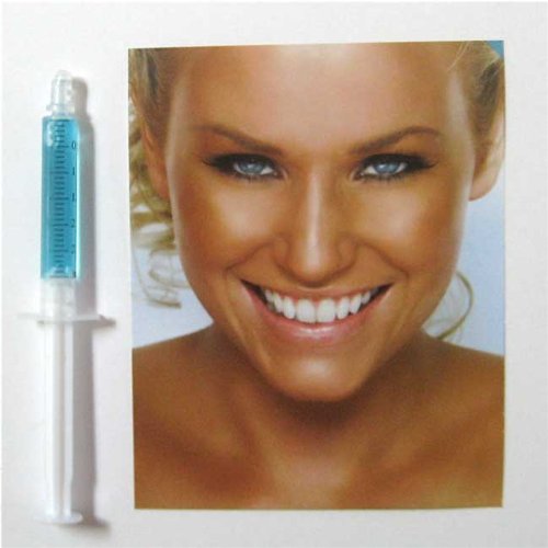 After Tooth-Whitening Remineralization Treatment