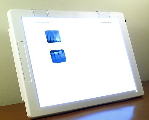 Professional Portable X-Ray Film/Negative/Slide Viewer