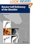 Rotator Cuff Deficiency of the Shoulder