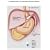 The Truth About Lapband Surgery