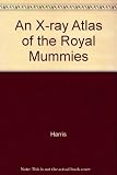 An X-ray atlas of the royal mummies
