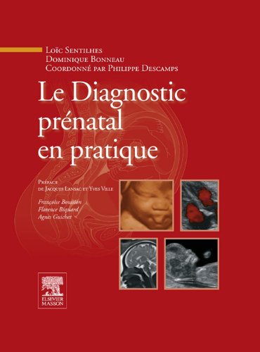 Le Diagnostic prénatal en pratique (French Edition)