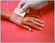 >Opsite iv drs trn 4x5.5 in. OpSite IV 3000 Dressing