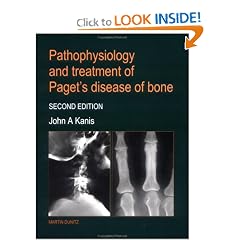 Pathophysiology and Treatment of Pagets Disease of Bone by John A. Kanis