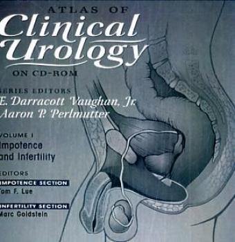 Infertility