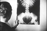 Vintage X-Ray Films DVD: A Video History of Medical Radiology & XRay Equipment