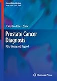 Prostate cancer diagnosis : PSA, biopsy and beyond