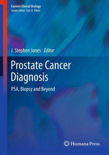 Prostate Cancer Diagnosis: PSA, Biopsy and Beyond (Current Clinical Urology)