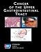 Cancer of the Upper Gastrointestinal Tract: A Volume in the American Cancer Society Atlas of Clinical Oncology Series: Esophagus/stomach (American Cancer Society Atlas of Clinical Oncology)