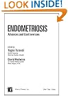 Endometriosis: Advances and Controversies
