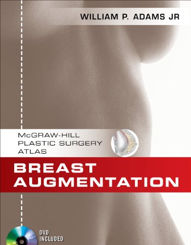 breast augmentation