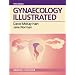 Gynaecology Illustrated