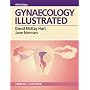 Gynaecology Illustrated